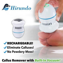 Load image into Gallery viewer, Hirundo Foot File and Callus Remover
