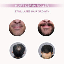 Load image into Gallery viewer, Titanium Needle Roller
